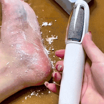 Lxaara Callus Remover