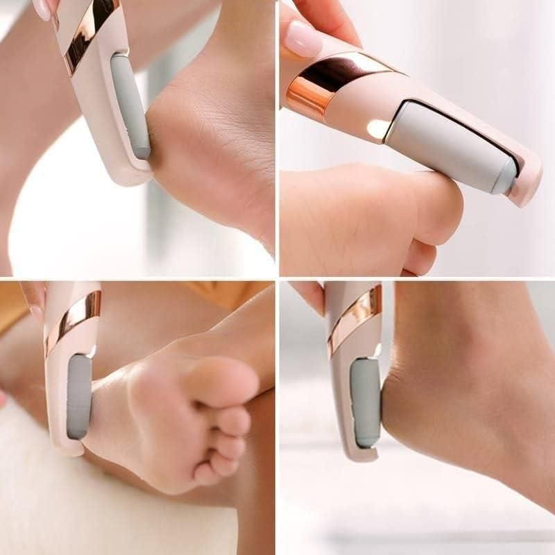 Lxaara Callus Remover