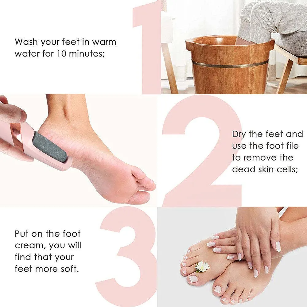 Lxaara Callus Remover